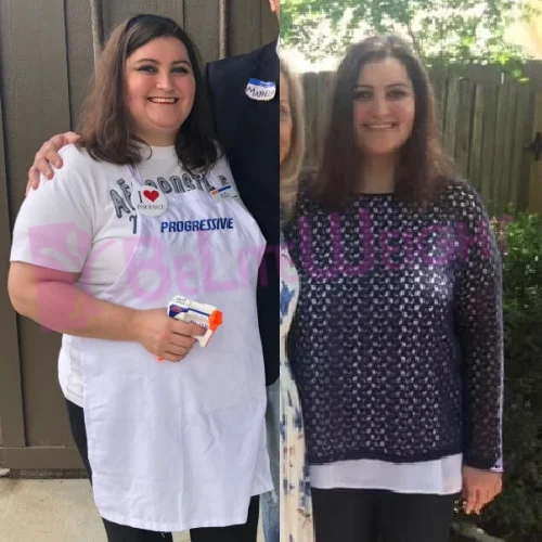Weight Loss With Gastric Sleeve Surgery Shelly S - 14 Month Update*